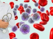 ¿QUÉ ES LA LEUCEMIA MIELOIDE AGUDA? LA PRIMERA CON MÁS CASOS NUEVOS CADA AÑO